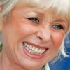 Close Up Barbara Windsor Paint By Numbers